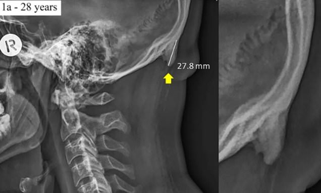 head-bones-Smartphonegreece (1).jpg