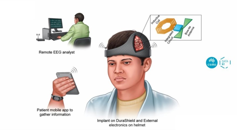 iEEG Monitoring-Smartphonegreece