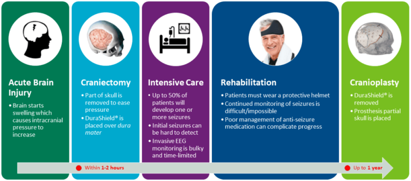 iEEG Monitoring-Smartphonegreece